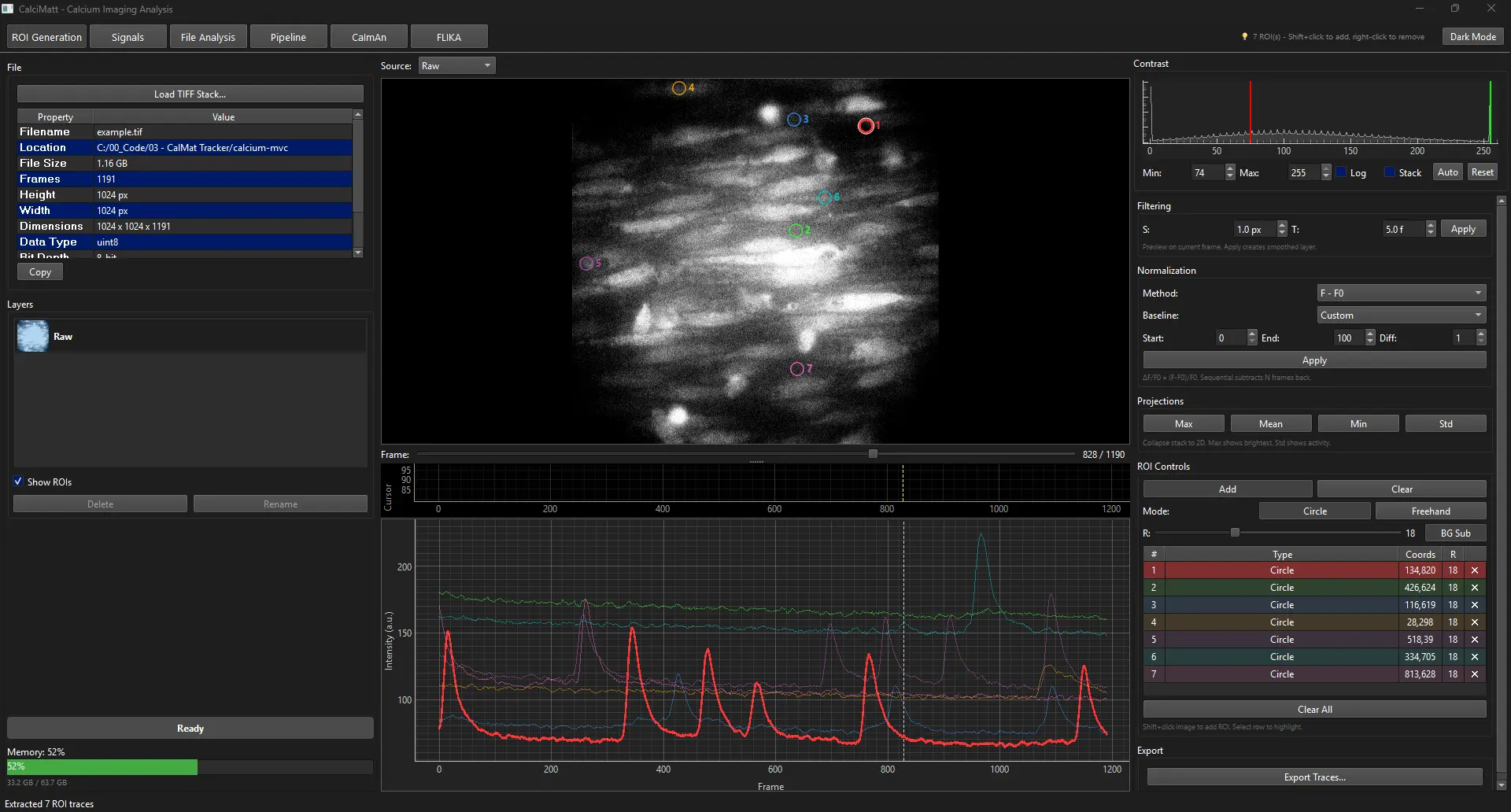 Ca2+Tracker software interface showing calcium trace analysis
